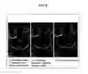 Fig. 09 - Method and apparatus for substantially isolating plant tissues