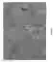 Fig. 08 - Inducing Premature Senescence to Stabilize Stem Cell Feeder Layer Cells