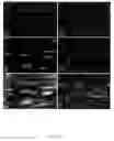 Fig. 07 - Methods and compositions for the repair and/or regeneration of damaged myocardium