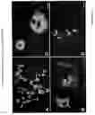 Fig. 72 - Methods and compositions for the repair and/or regeneration of damaged myocardium