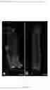 Fig. 85 - Methods and compositions for the repair and/or regeneration of damaged myocardium