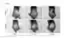 Fig. 06 - Compositions and Methods for Preventing and Treating Hair Growth Cycle-Related Conditions