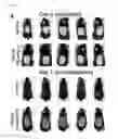 Fig. 09 - Compositions and Methods for Preventing and Treating Hair Growth Cycle-Related Conditions