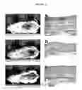 Fig. 22 - Antimicrobial nanoemulsion compositions and methods