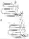 Fig. 41 - Double Loop Technology