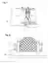 Fig. 02 - METHOD FOR MAPPING IMAGE REFERENCE POINTS TO FACILITATE BIOPSY USING MAGNETIC RESONANCE IMAGING