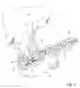 Fig. 02 - Biliary Shunts, Delivery Systems, Methods of Using the Same and Kits Therefor