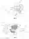 Fig. 07 - Methods and systems for repairing an intervertebral disc using a transcorporal approach