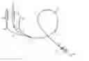 Fig. 01 - BALLOON CATHETER WITH SAFETY FEATURE