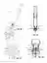 Fig. 06 - Interfacing a prefilled syringe with an infusion pump to fill the infusion pump