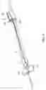 Fig. 07 - INDWELLING NEEDLE ASSEMBLY