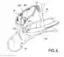 Fig. 08 - Methods, Devices, Kits and Systems for Defunctionalizing the Gallbladder