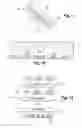 Fig. 06 - DEVICE FOR ASSISTANCE IN THE WOUND HEALING PROCESSES