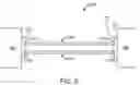 Fig. 06 - IMPLANTABLE DEVICE WITH ELECTROLYTICALLY DETACHABLE JUNCTION HAVING MULTIPLE FINE WIRES AND METHOD OF INTRODUCTION