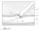 Fig. 24 - Vascular closure devices, systems, and methods of use