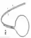 Fig. 09 - Devices, systems, and methods for closing the left atrial appendage