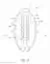 Fig. 23 - Axially-radially nested expandable device