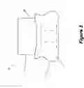 Fig. 04 - Inflatable hospital bed and method of using same