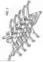 Fig. 06 - Storable intravenous stands