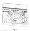 Fig. 07 - Mounting plate to hold medical instruments and implants using posts with flexible holders