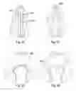 Fig. 13 - Retention system