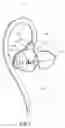 Fig. 02 - In-ear headphones