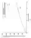 Fig. 08 - Toro: tracking and observing robot