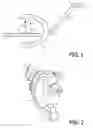 Fig. 02 - Image processing system and method for displaying images during interventional procedures