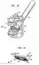 Fig. 09 - External fixation clamp