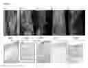 Fig. 02 - Compositions for inhibiting atherosclerosis
