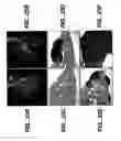 Fig. 28 - Methods and compositions for modulating and detecting wisp activity