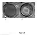 Fig. 09 - COMPOSITIONS AND METHODS FOR TREATING PULP INFLAMMATIONS CAUSED BY INFECTION OR TRAUMA