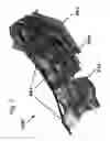 Fig. 08 - DESIGN OF DENTAL APPLIANCES