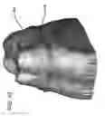 Fig. 28 - DESIGN OF DENTAL APPLIANCES