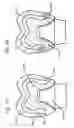 Fig. 35 - DESIGN OF DENTAL APPLIANCES