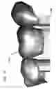 Fig. 40 - DESIGN OF DENTAL APPLIANCES