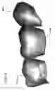 Fig. 41 - DESIGN OF DENTAL APPLIANCES