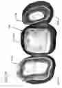 Fig. 44 - DESIGN OF DENTAL APPLIANCES