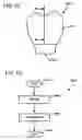 Fig. 47 - DESIGN OF DENTAL APPLIANCES