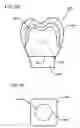 Fig. 48 - DESIGN OF DENTAL APPLIANCES