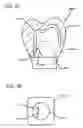 Fig. 49 - DESIGN OF DENTAL APPLIANCES
