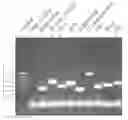 Fig. 01 - IDENTIFICATION OF MICROORGANISMS CAUSING ACUTE RESPIRATORY TRACT INFECTIONS (ARI)