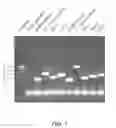 Fig. 02 - IDENTIFICATION OF MICROORGANISMS CAUSING ACUTE RESPIRATORY TRACT INFECTIONS (ARI)