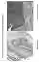Fig. 07 - METHODS AND COMPOSITIONS FOR THE DETECTION OF CERVICAL DISEASE