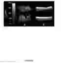 Fig. 28 - Methods for the generation of cartilage-like material by mechanical loading