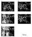 Fig. 06 - Method and devices for treating individual biological cells