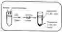 Fig. 01 - Method of quantitatively measuring small particle low density lipoproteins