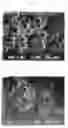 Fig. 02 - Process of producing a particle having a core-shell structure