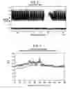 Fig. 03 - SYSTEMS AND METHODS FOR DETERMINING INTRACRANIAL PRESSURE NON-INVASIVELY AND ACOUSTIC TRANSDUCER ASSEMBLIES FOR USE IN SUCH SYSTEMS