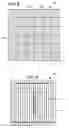 Fig. 05 - SYSTEMS AND METHODS FOR DETERMINING INTRACRANIAL PRESSURE NON-INVASIVELY AND ACOUSTIC TRANSDUCER ASSEMBLIES FOR USE IN SUCH SYSTEMS